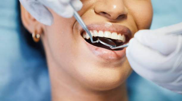 Best Cracked Tooth Emergency Dentist  in Brush, CO
